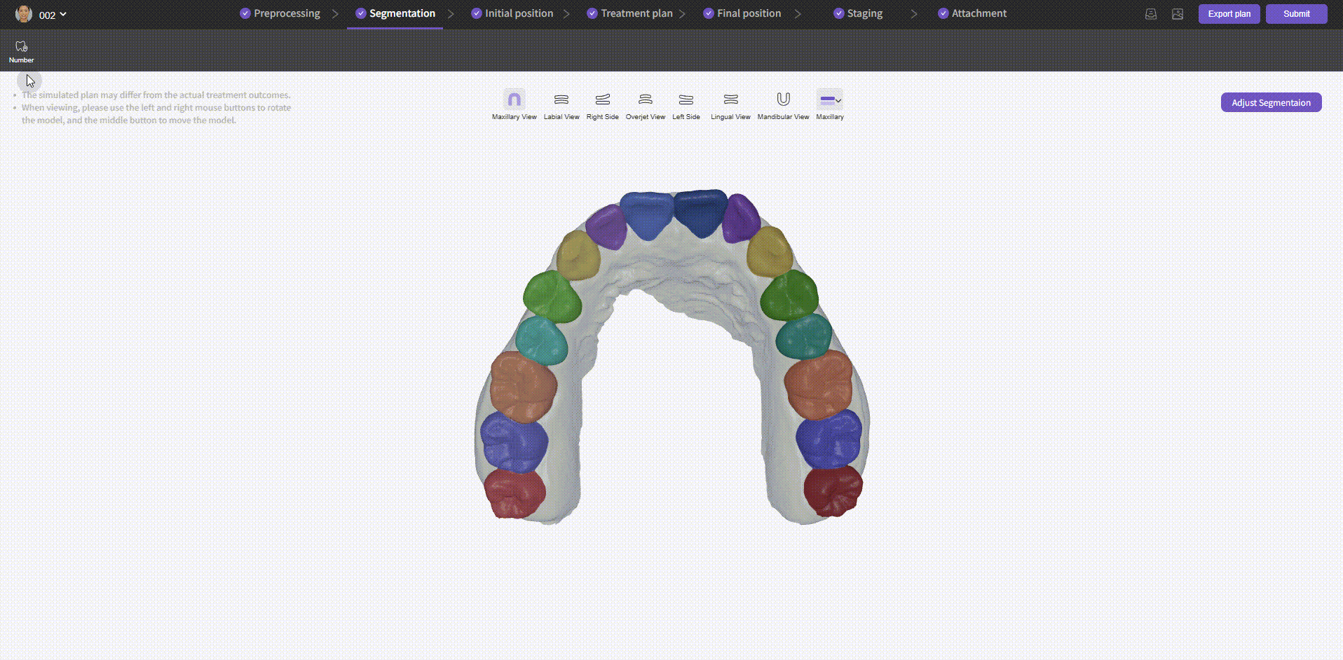 Segmentation