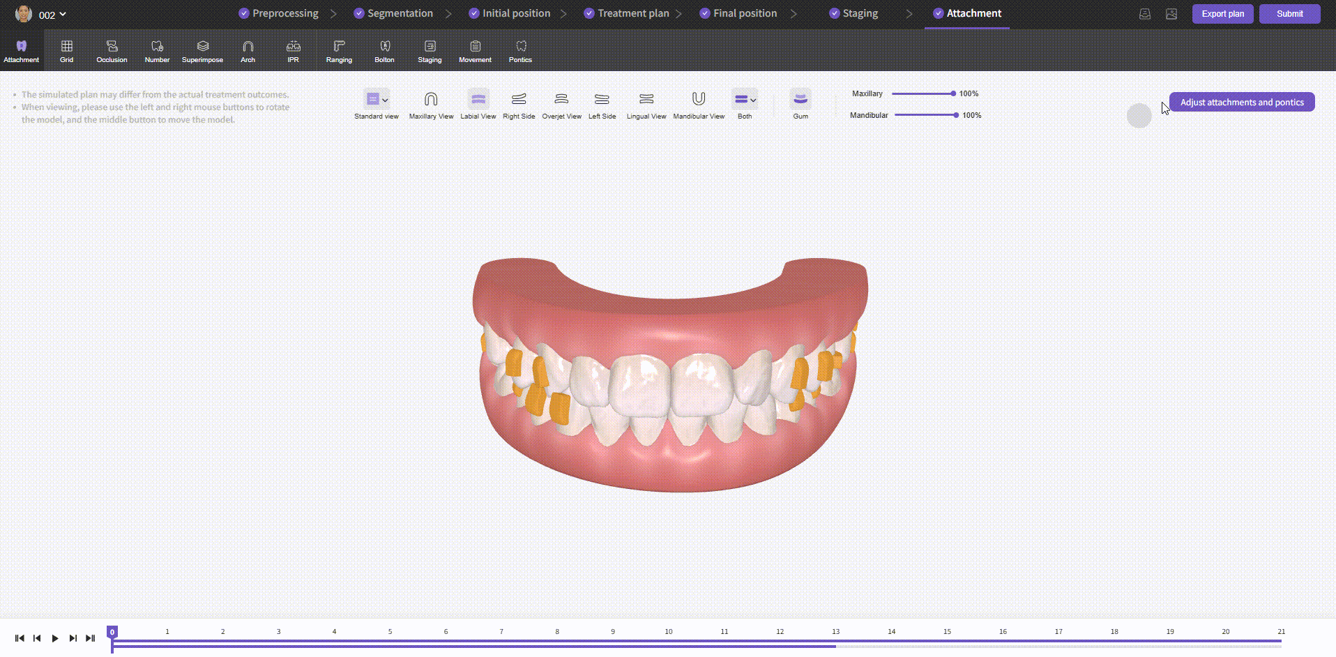 Export - Staging Video