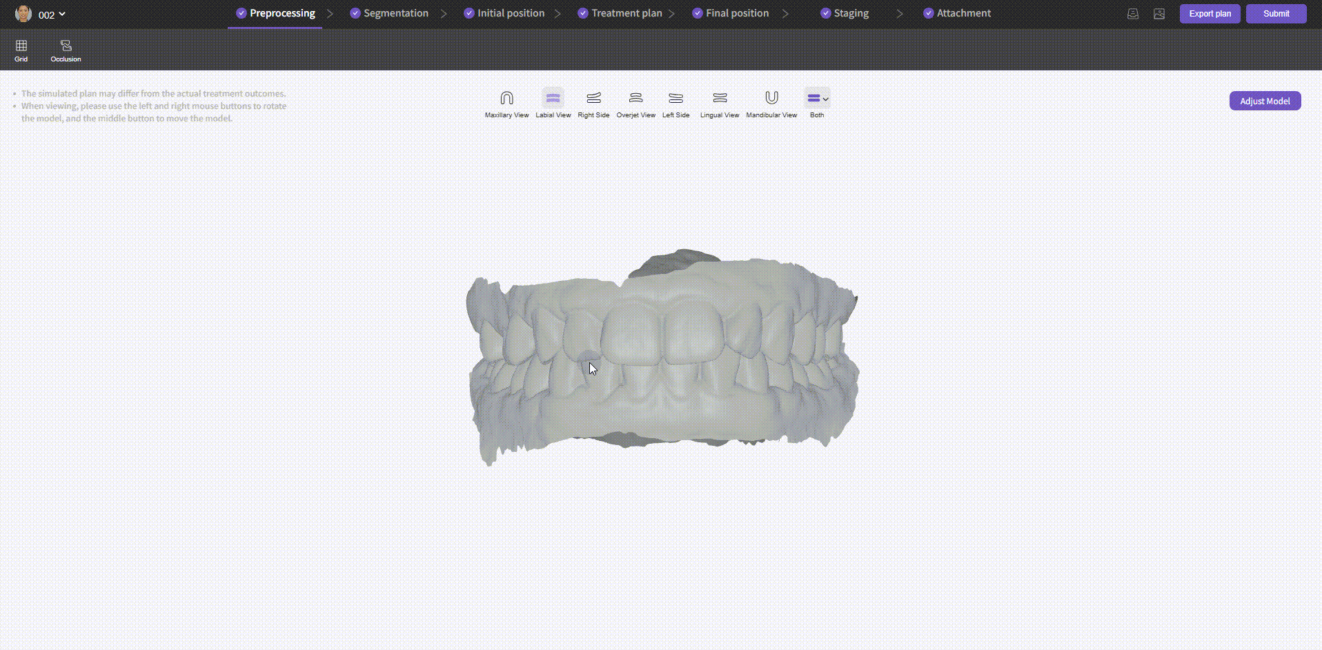 Model Preprocessing - Views