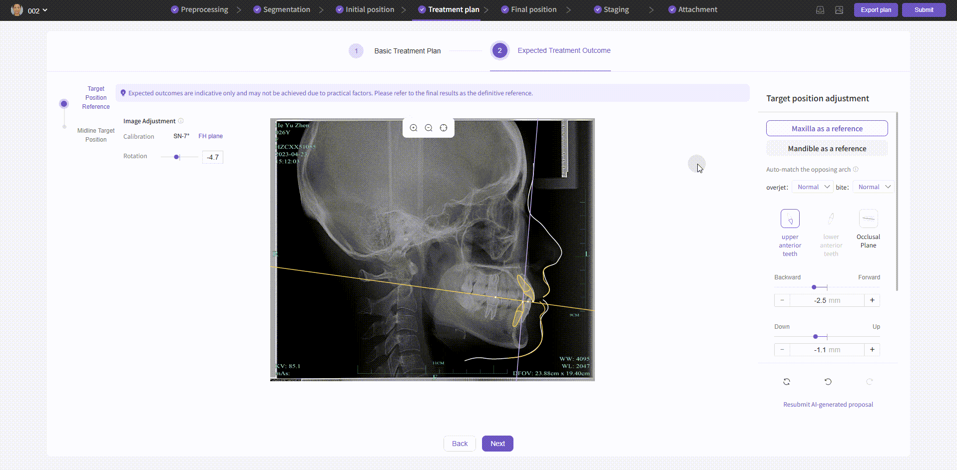 Treatment Plan - Expected Outcome