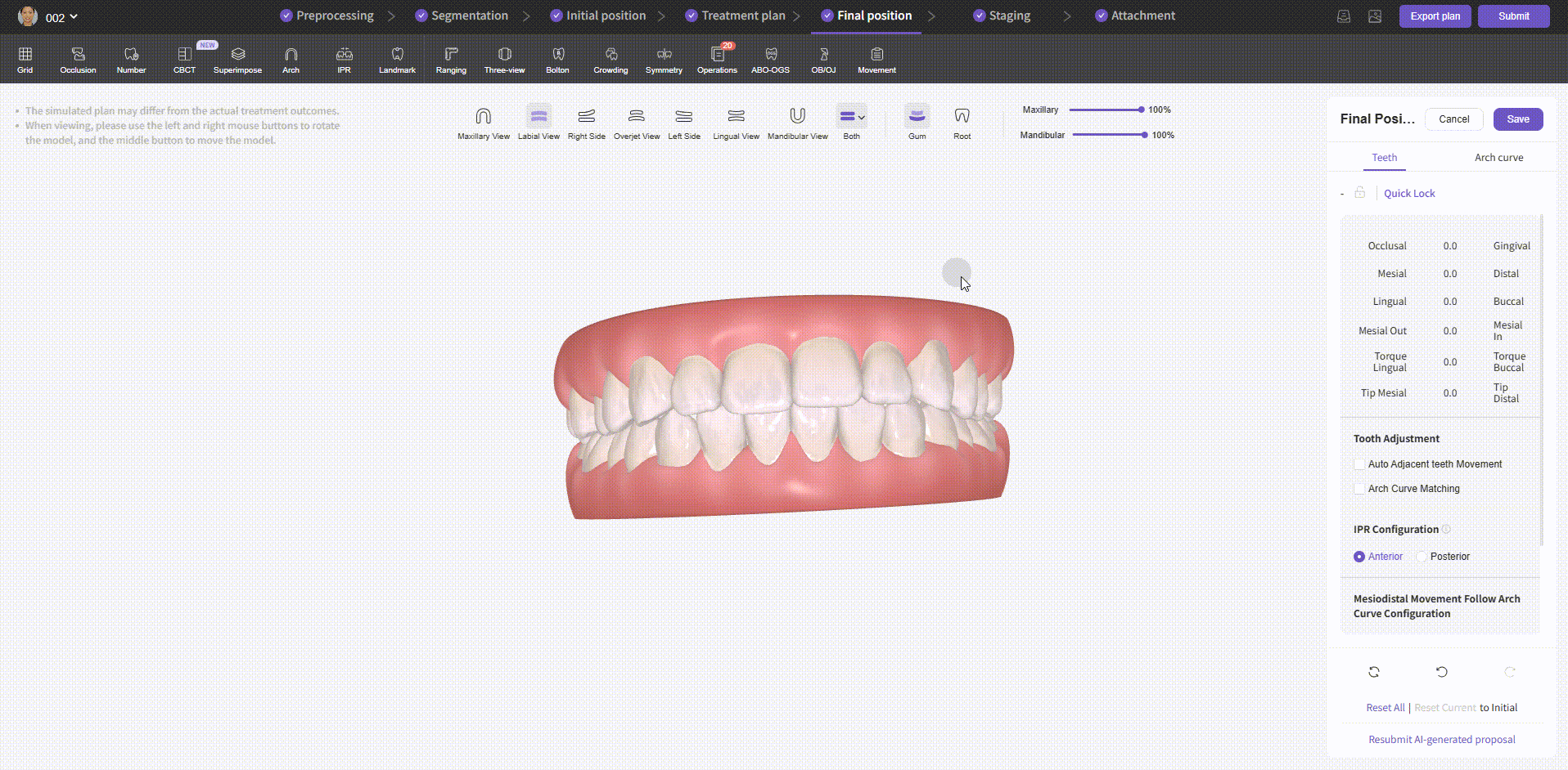 Adjust Final Position - Tooth Movement